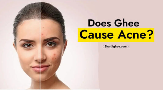 Does Ghee Cause Acne? - Shahjighee Shahji Ghee