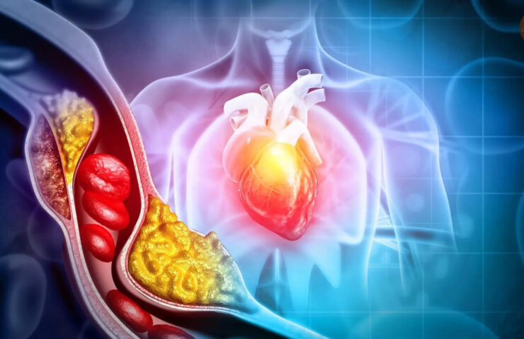 A2 ghee impact on cholesterol level